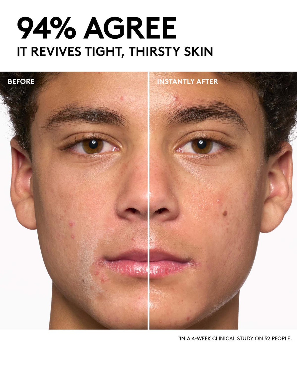 Day + Night Hydrating Routine: Dew N Plump Serum + Slushie Mask